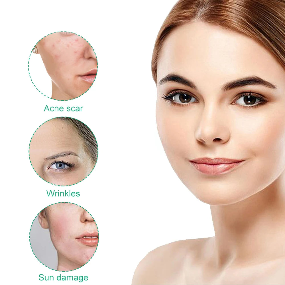 Raaziq Mall® ChillGlow  Ice Roller|Face Lifter& Anti-Wrinkle Massager